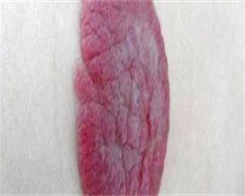 常德市第一人民医院代生公司官网成功率和费用明细介绍，建议收藏！
						