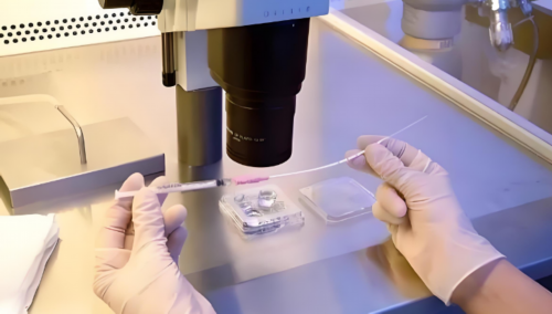 为什么前面做了两次代生套餐费用放冻胚后肚子都有屎感？