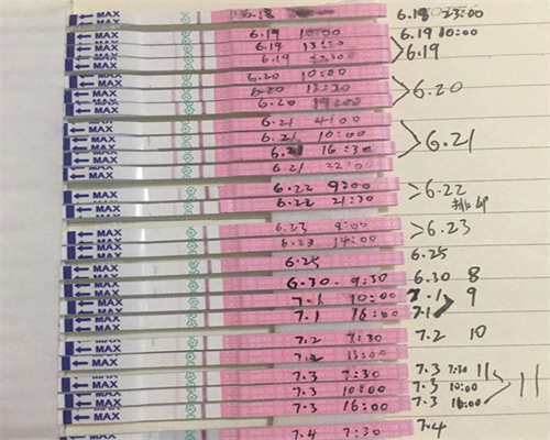 促排卵多少钱一次