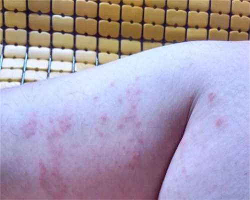 专业代生子-无锡夫妻做试管婴儿要多少钱,无锡试管婴儿医院排名最好