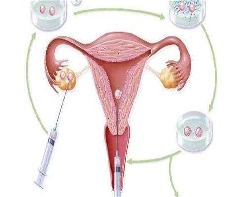 继发不孕做试管有优势吗？继发不孕做试管成功率高吗？