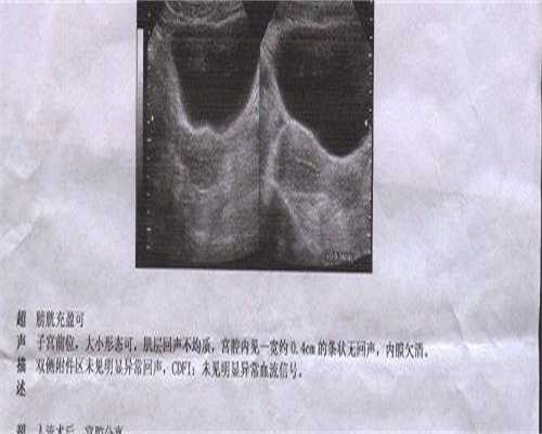 做试管代孕的步骤有哪些,精子浓度范围参考值(精子活力值)