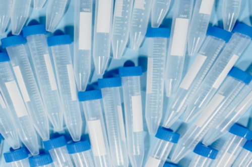 无锡人工授精的价格是多少,大概多少钱一次说清