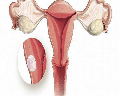 柬埔寨自助试过供卵费用多少最佳医院成功率有多高(柬埔寨试过供卵费用多少