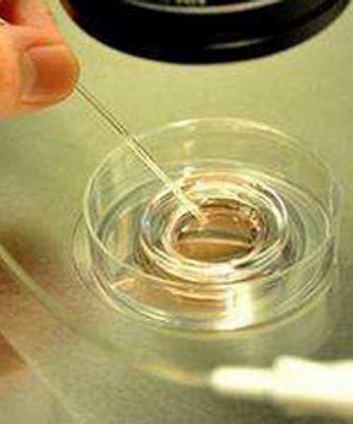 移植后需要长期卧床休息吗?