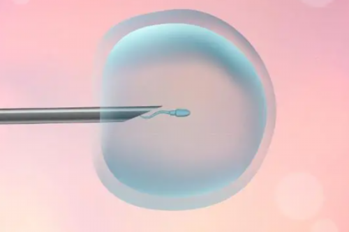 代孕包生孩子-试管婴儿微刺方案是什么?有哪些试管婴儿方案?