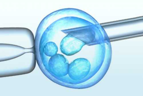 巧克力囊肿的治疗方法巧克力囊肿做试管婴儿