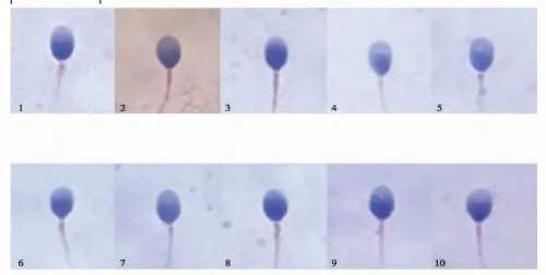 供卵包男孩_35万包男孩,
              宫腔粘连术后内膜薄一年还没怀孕怎么办？