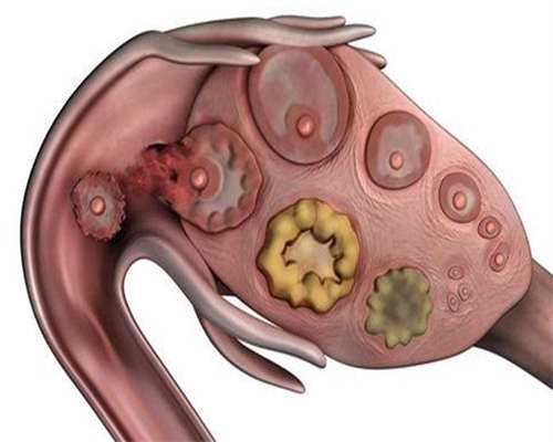 第二代高龄代生宝宝，不孕家庭选择前需谨慎