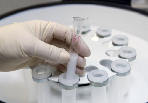 2026无锡市人民医院试管婴儿要多少钱(附费用筹算指南)