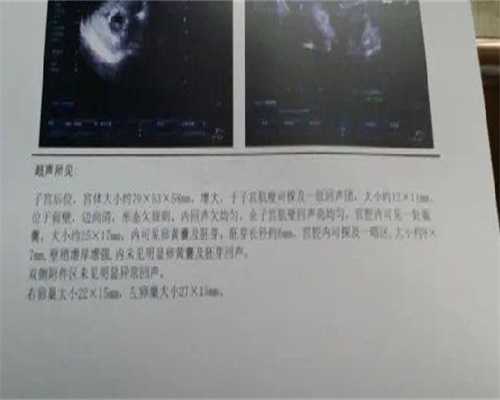 子宫畸形能怀孕吗