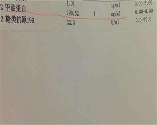 无锡101医院试管婴儿的成功率如何？由五部分组成！