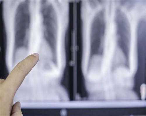 做试管基础卵泡少咋办呢？试管卵泡太少是不是几率不高