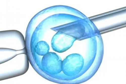 哪一家做代孕好,宫外孕开窗取胚术后输卵管还能使用吗？输卵管粘连术后需要